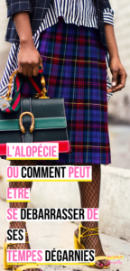 L'alopécie ou comment peut-être se débarrassez de ses tempes dégarnies blog beauté naturelle des cheveux crépus une reine en chaussettes